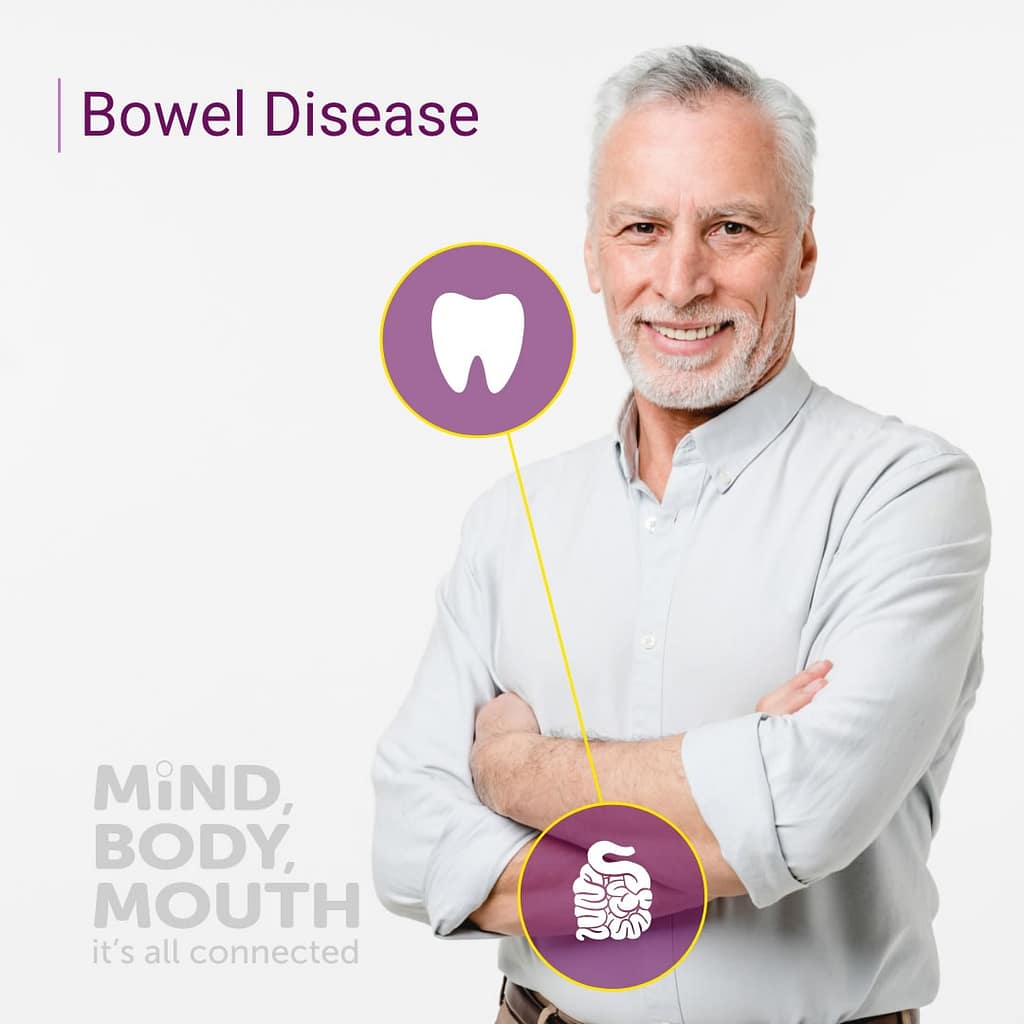Inflammatory Bowel Disease 