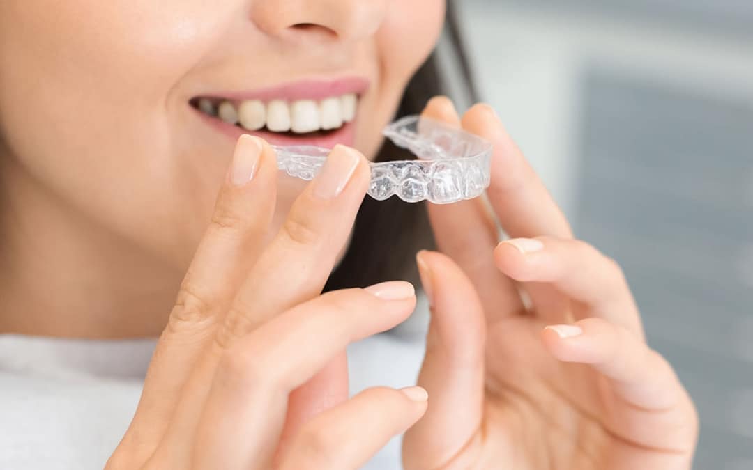Invisalign