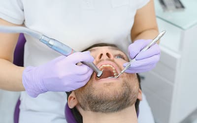 Fissure Sealants